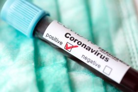 Coronavirus cases on upward trend in Georgia 