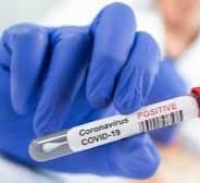 The US is about to top 500,000 Covid-19 deaths. That’s why it’s critical to keep up safety measures, Fauci says