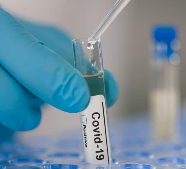 Out of 355 new cases of coronavirus, 176 were detected in Tbilisi