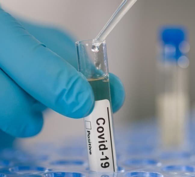 The number of COVID-19 infections in the world exceeded 116 million, the number of victims – 2.58 million