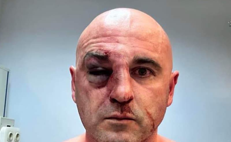 “ნაციონალური მოძრაობის” ინფორმაციით, ლევან ხაბეიშვილი დაკავებულია