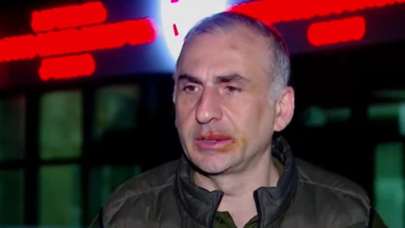 ალეკო ელისაშვილი – რამდენიმე პოლიციელმა შემათრია, შეთრევის დროს წავიქეცი და დაგდებულს მირტყამდნენ გამეტებით, ერთი ნეკნი მაქვს მოტეხილი