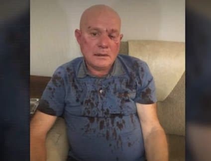 დავით კირკიტაძე – მას დაემუქრნენ რამდენიმე დღის წინ და აუსრულეს კიდეც “ქართული ოცნების” აქტივისტებმა