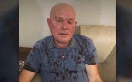 Man names ‘political motive’ behind attack