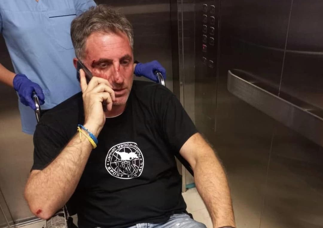 ლევან ხაბეიშვილი – “ნიღბებით” საცხოვრებელ სახლთან დახვდნენ და უმოწყალოდ სცემეს “ნაციონალური მოძრაობის” სამეურნეო სამსახურის თანამშრომელი