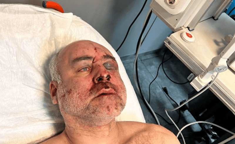 Frontnews image description