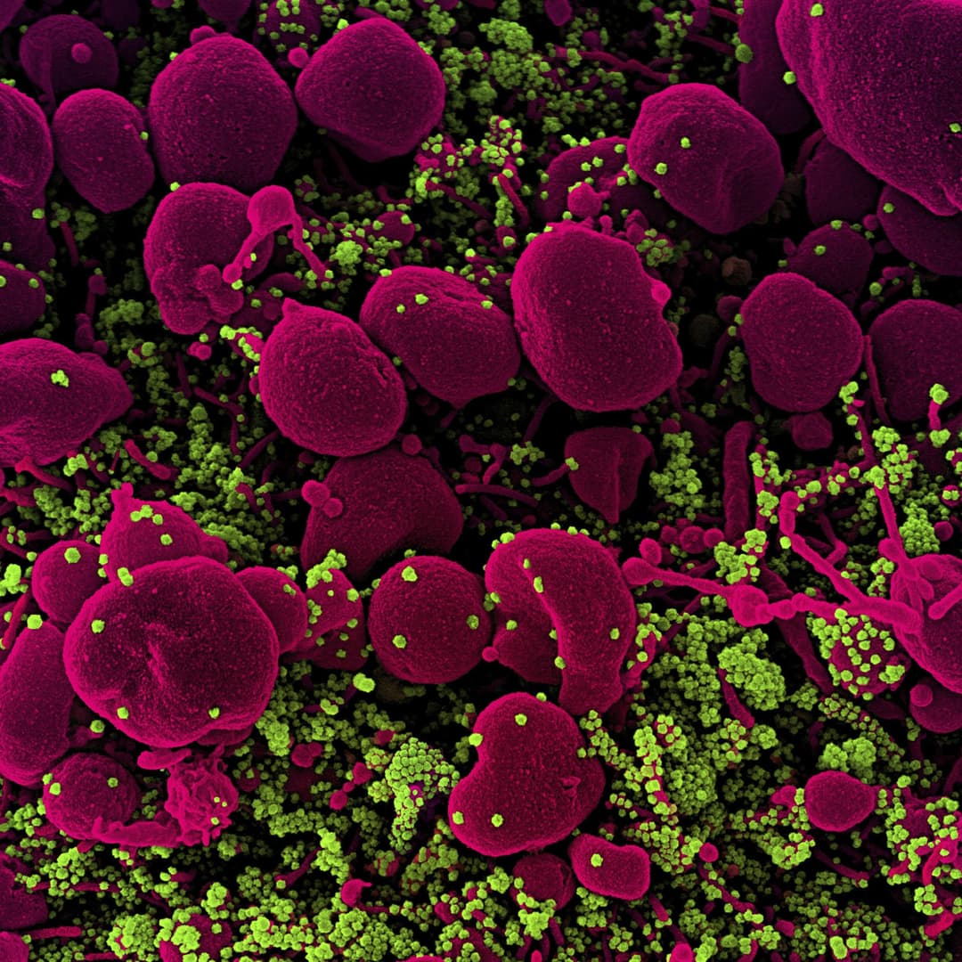 სამხრეთ აფრიკის რესპუბლიკაში კორონავირუსის ახალი შტამი დაფიქსირდა