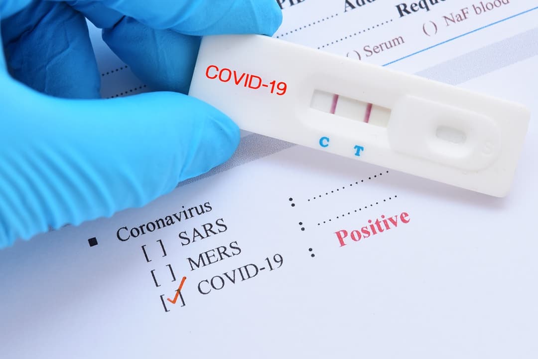 People with no previous history of Covid contract the virus more easily – doctor
