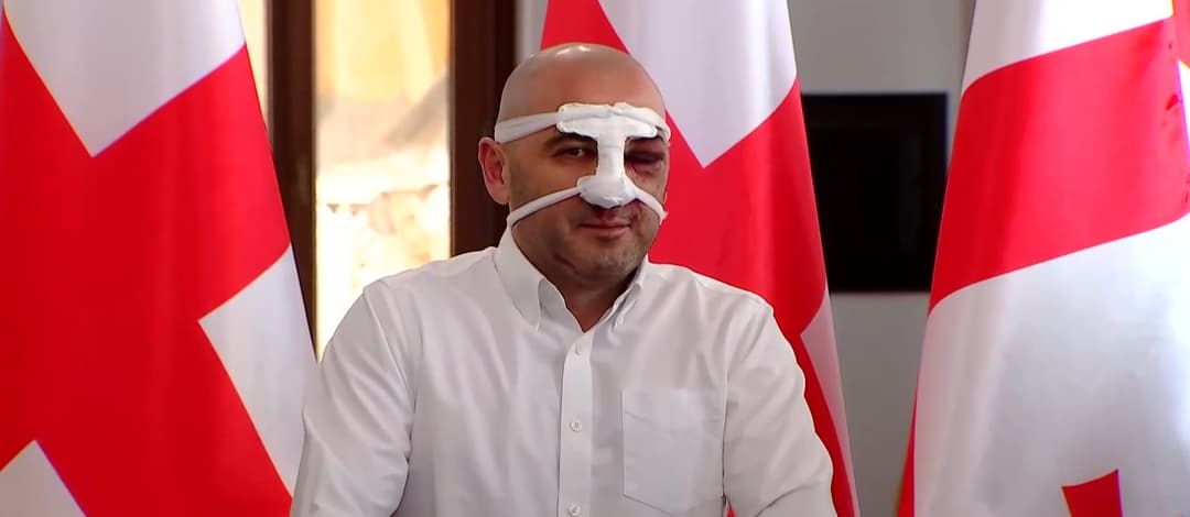 ლევან ხაბეიშვილი – იმ ახალგაზრდების გამო, ვისაც თმის ღერი ჩამოუვარდა, გთხოვთ კიდევ ერთხელ, რომ ეს კანონი გაიტანოთ