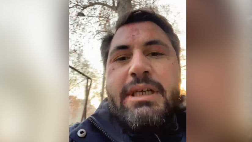 Man assaulted by Georgian ruling party MPs in Abu Dhabi also attacked in Tbilisi