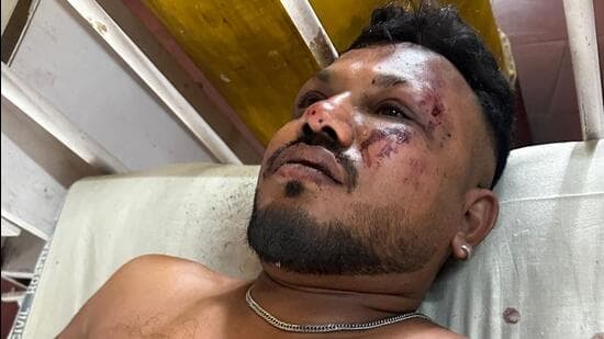 ინდოეთში ავიაკატასტროფის დროს ერთი მგზავრი გადარჩა