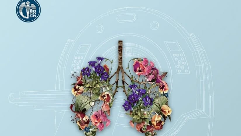 Tbilisi City Hall to fund free lung cancer screening programme from May