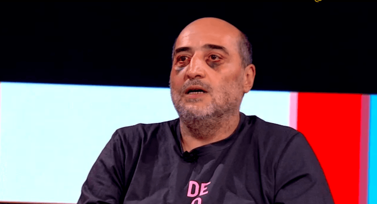 მიშა მშვილდაძეზე თავდასხმის საქმეს სპეციალური საგამოძიებო სამსახური გამოიძიებს