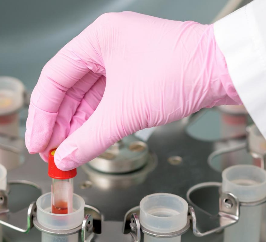 A highly infectious “Brazilian” strain of COVID-19, from which the vaccine may not protect, has been identified in the US – Golubovskaya