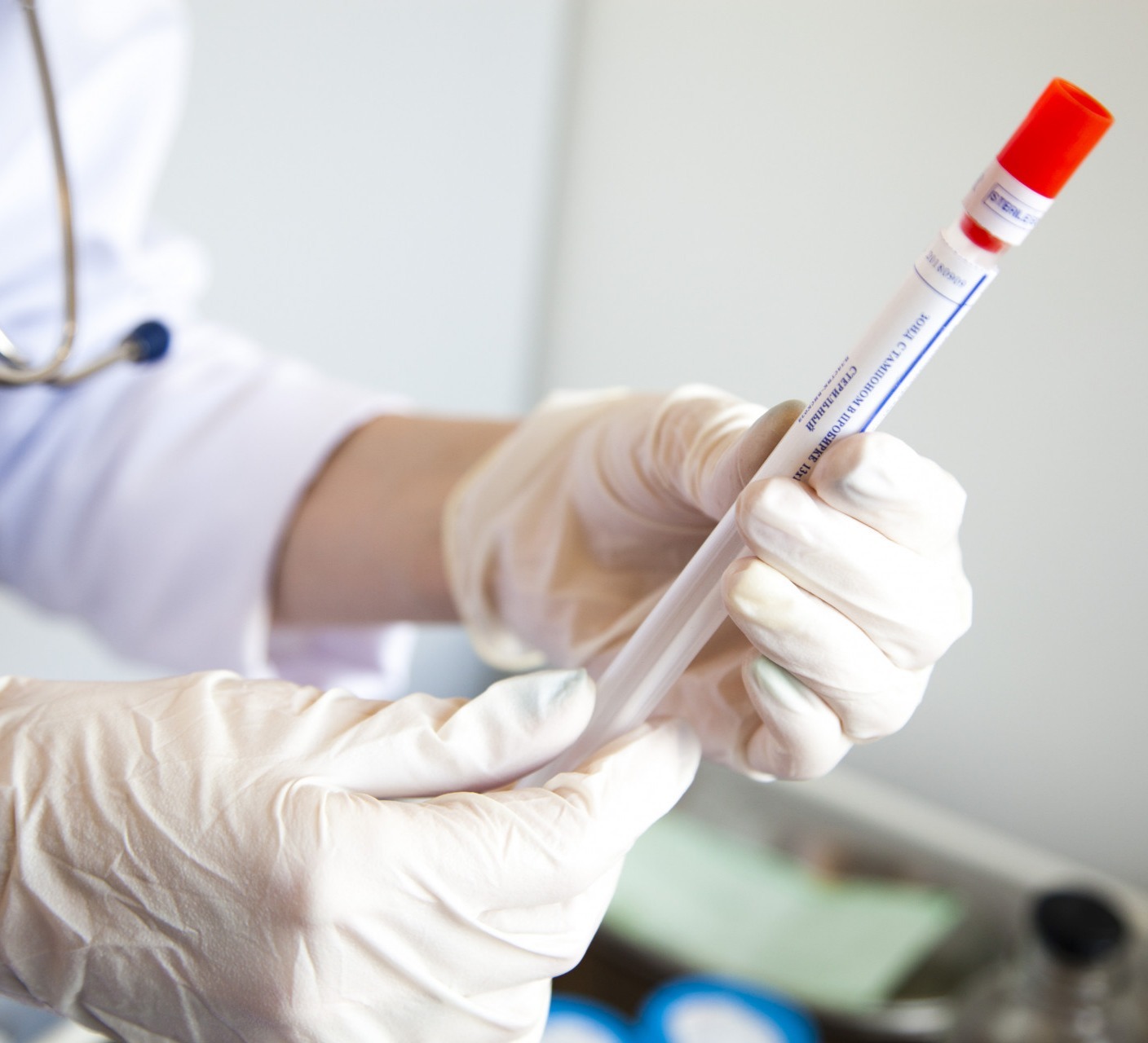 კორონავირუსის 544 ახალი შემთხვევიდან 226 თბილისში გამოვლინდა