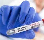 The US is about to top 500,000 Covid-19 deaths. That’s why it’s critical to keep up safety measures, Fauci says